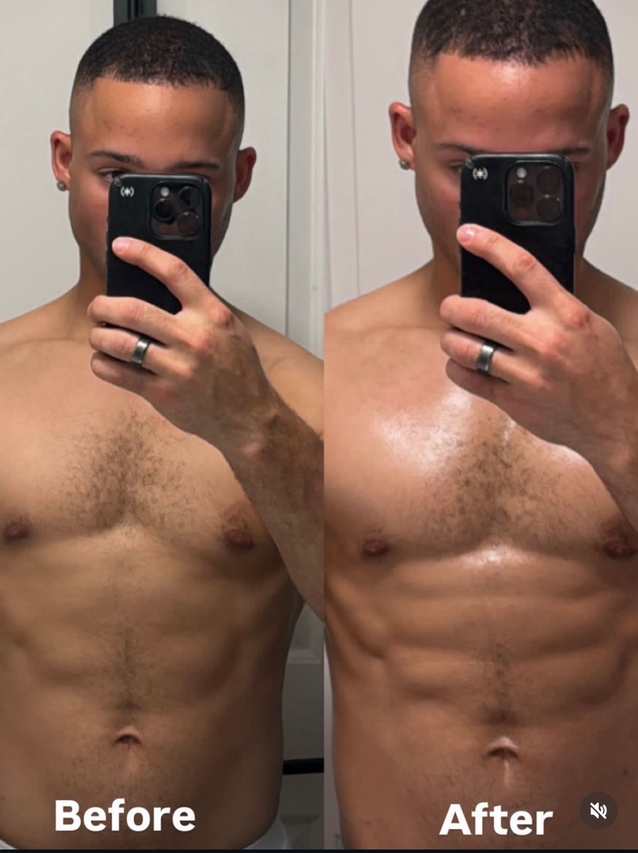Client before and after VIP Sculpt, showing the torso